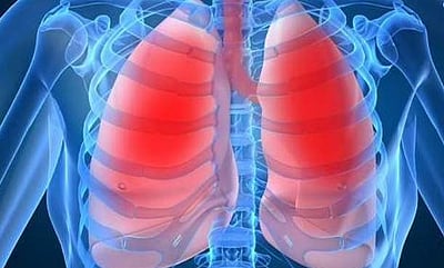 காசநோய் இல்லா இந்தியா காண்போம்!