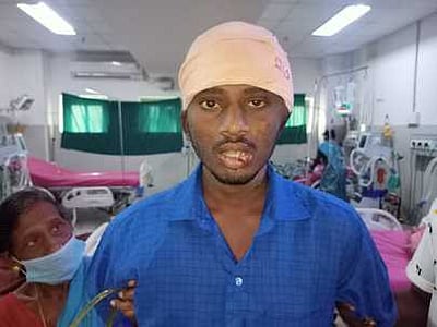 இளைஞரின் தலையில் பாய்ந்த கத்தி:அறுவை சிகிச்சை மூலம் அகற்றம்