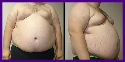 சுகம் தரும் சித்த மருத்துவம்: உடல் பருமன் கவலையை ‘கருணைக்கிழங்கு’ போக்குமா?