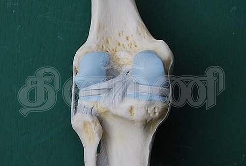 சுகம் தரும் சித்த மருத்துவம்: மூட்டு தேய்மானத்திற்கு ‘முடக்கறுத்தான்’ தீர்வு தருமா..?