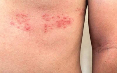 ரத்தத்தின் ரத்தமே - 64