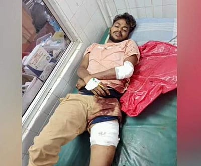 நெல்லையில் உணவகத்தில் தகராறு: இளைஞருக்கு அரிவாள் வெட்டு