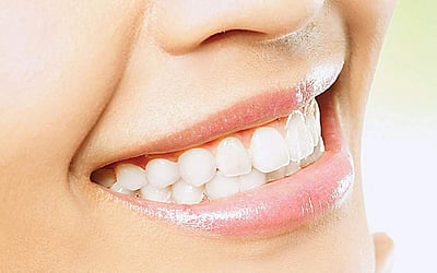 பற்களை பாதுகாப்போம்