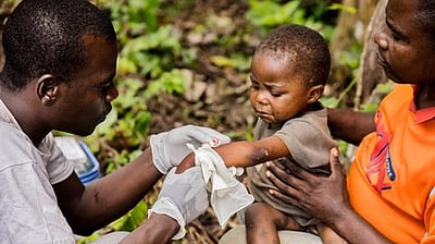 பிரிட்டன்20 நாடுகளில் 200 பேருக்கு குரங்கு அம்மை பாதிப்பு