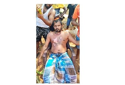 திருச்சி மத்திய சிறையில் உண்ணாவிரதத்தில் இருந்த ஈழத்தமிழர் தீக்குளிப்பு