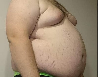 சுகம் தரும் சித்த மருத்துவம்: தொற்றா நோய்க்கூட்டங்களின் அரசனை அழிக்குமா ‘திரிபலை’?