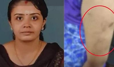 கொச்சி அருகே சிறுநீர் குடிக்க வைத்து சிறுமி சித்ரவதை: சித்தி கைது 