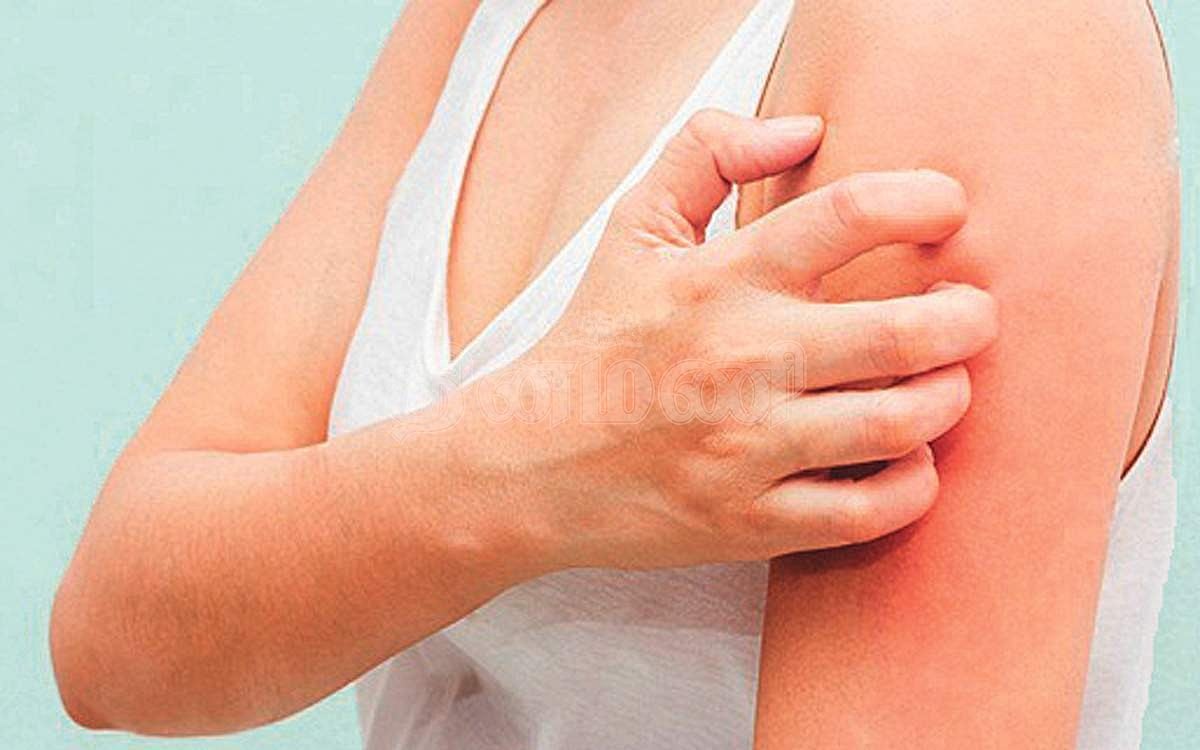 ஆயுள் காக்கும் ஆயுர்வேதம்: உடல் எரிச்சல் குணமடைய?