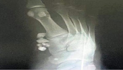 இப்படி செய்தால் எப்படி? அறந்தாங்கி அரசு மருத்துவமனையில் நடந்த அவலம்