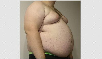 சுகம் தரும் சித்த மருத்துவம்: உடல் பருமனைக் குறைக்குமா ‘நத்தை சூரி’..?  