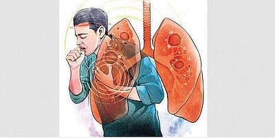 கரோனாவுக்குப் பின் குழந்தைகளிடையே அதிகரிக்கும் சுவாசநோய்கள்