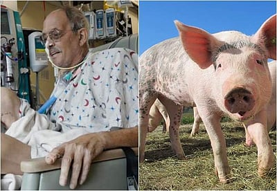 பன்றியின் இதயம் பொருத்தப்பட்ட மனிதர்: 40 நாள்களுக்குப் பிறகு உயிரிழப்பு!