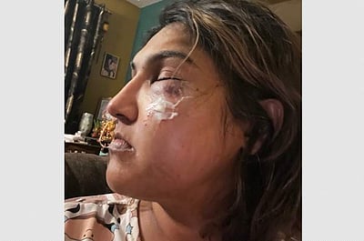 நடிகை வனிதாவை தாக்கிய பிரதீப் ஆண்டனி ஆதரவாளர்!