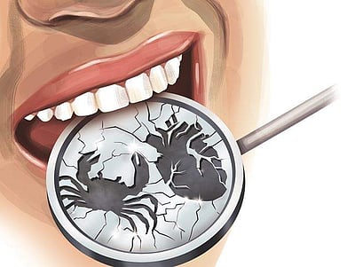 திருமண மண்டபங்கள், ஹோட்டல்களில் வாய் கொப்புளிக்காதீர்கள்!