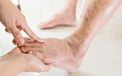 ஆயுள் காக்கும் ஆயுர்வேதம்: நீரிழிவு நோய் பாதிப்பு தப்பிக்க வழி?