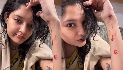 படப்பிடிப்பில் நடிகை ரித்திகா சிங்குக்கு காயம்!