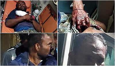 கோடியக்கரை அருகே நாகை மீனவர்கள் மீது இலங்கை கொள்ளையர்கள் தாக்குதல்: 7 பேர் காயம்