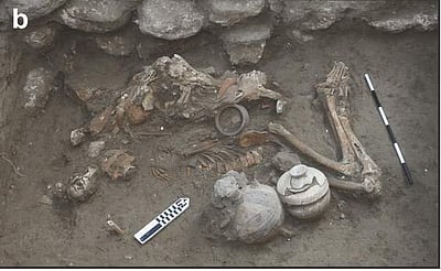 3000 ஆண்டுகளுக்கு முன்பே மூளை அறுவைசிகிச்சையா? அதிரும் விஞ்ஞானிகள்