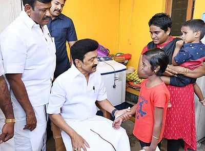 முகச்சிதைவு நோயால் பாதிக்கப்பட்ட சிறுமியை நேரில் சந்தித்து நலம் விசாரித்த முதல்வர்!