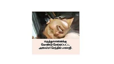 மருத்துவமனைக்கு அழைத்துச் செல்லப்பட்ட அமைச்சர் செந்தில் பாலாஜி