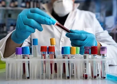 தமிழக அரசு மருத்துவமனைகளில் 332 லேப் டெக்னீஷியன் பணி: விண்ணப்பங்கள் வரவேற்பு