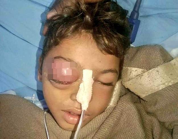 சிறுவன் இந்திரா மேக்வால்